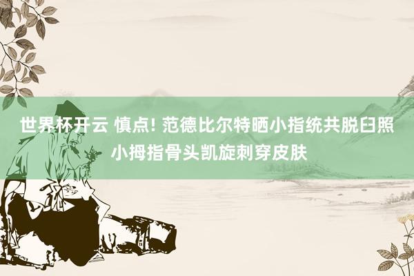 世界杯开云 慎点! 范德比尔特晒小指统共脱臼照 小拇指骨头凯旋刺穿皮肤